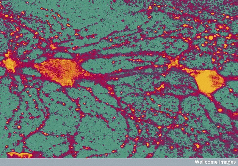 Het effect van stress op het brein - neuronen